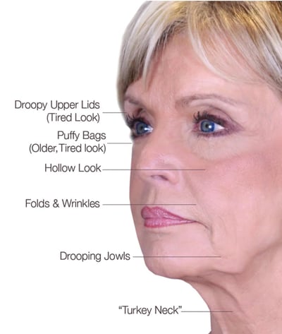 signs of aging signs of aging